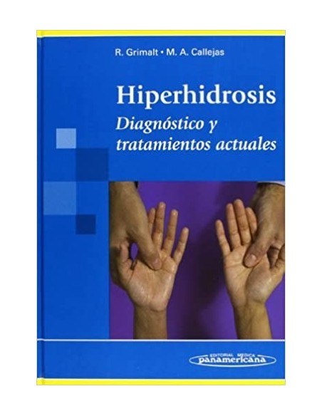 Hiperhidrosis Diagnóstico y tratamientos actuales