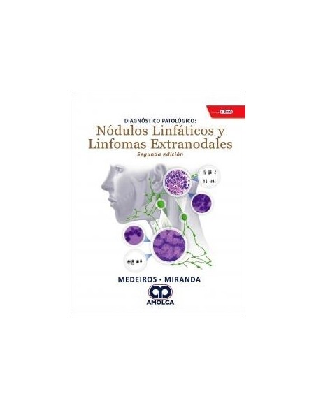 Diagnóstico Patológico: Nódulos Linfáticos y Linfomas Extranodales