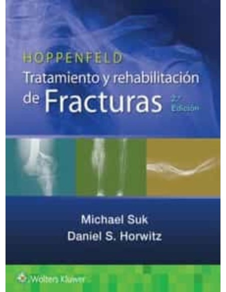 HOPPENFELD Tratamiento y Rehabilitación de Fracturas