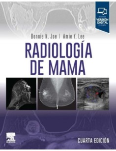 Radiología de mama