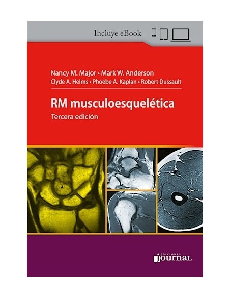 RM Musculoesquelética
