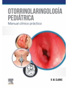 Otorrinolaringología pediátrica