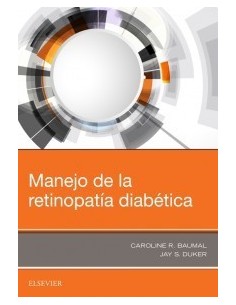 Manejo de la retinopatía diabética