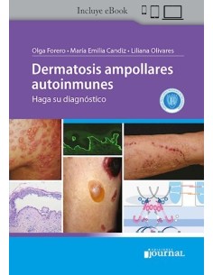 Dermatosis Ampollares Autoinmunes. Haga su Diagnóstico