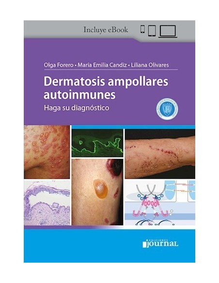 Dermatosis Ampollares Autoinmunes. Haga su Diagnóstico