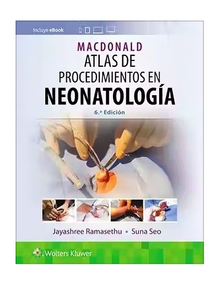 MAcDONALD Atlas de Procedimientos en Neonatología
