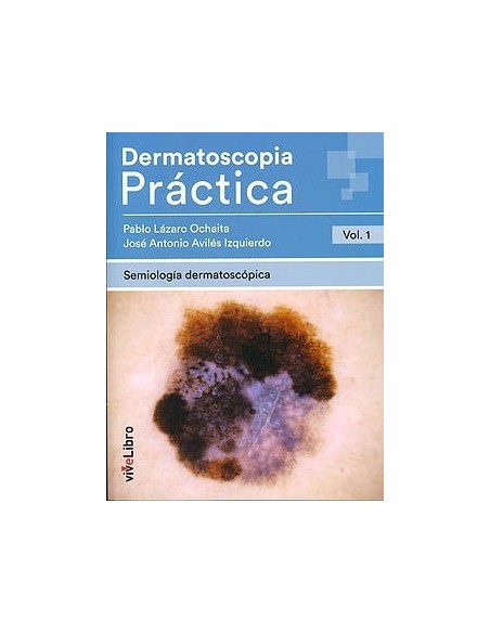 Dermatoscopia Práctica