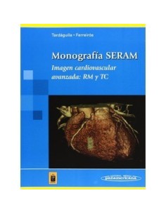Imagen Cardiovascular Avanzada: RM y TC "Monografía SERAM"