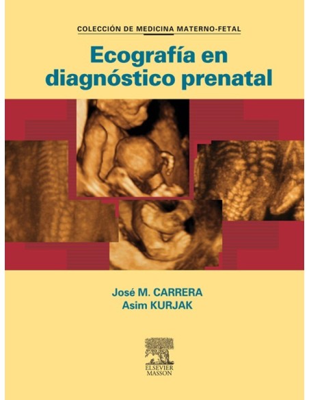 Ecografía en Diagnóstico Prenatal