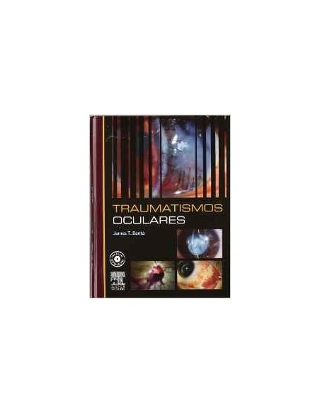 Traumatismos Oculares "Incluye DVD"