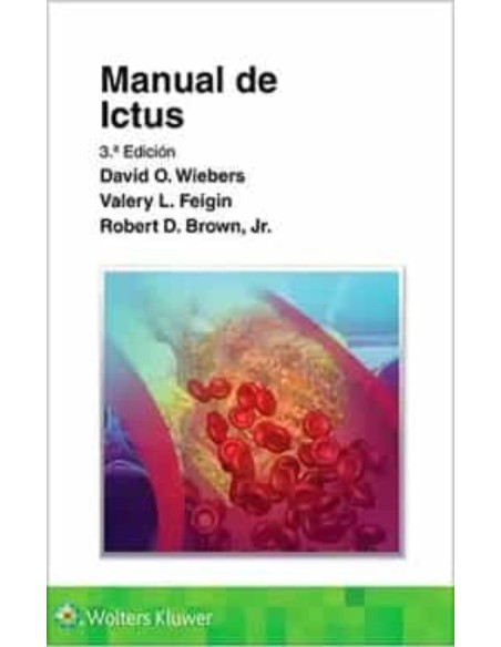 Manual de ictus