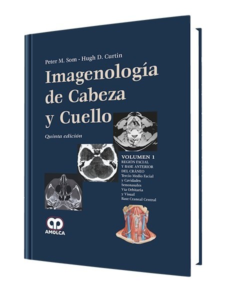 Imagenología de Cabeza y Cuello