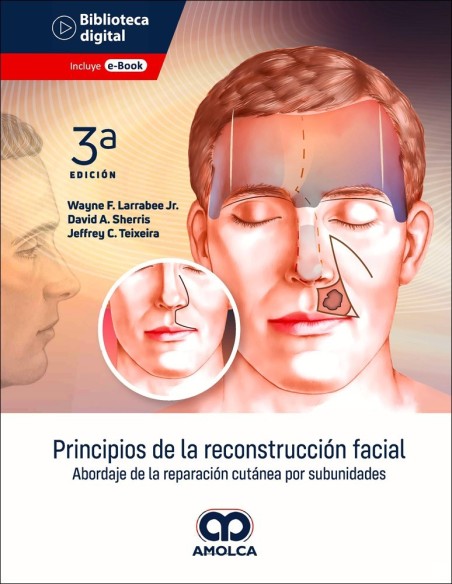 Principios de la Reconstrucción Facial. Abordaje de la Reparación Cutánea por Subunidades