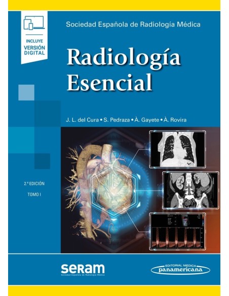 SERAM Radiología Esencial (2 tomos)