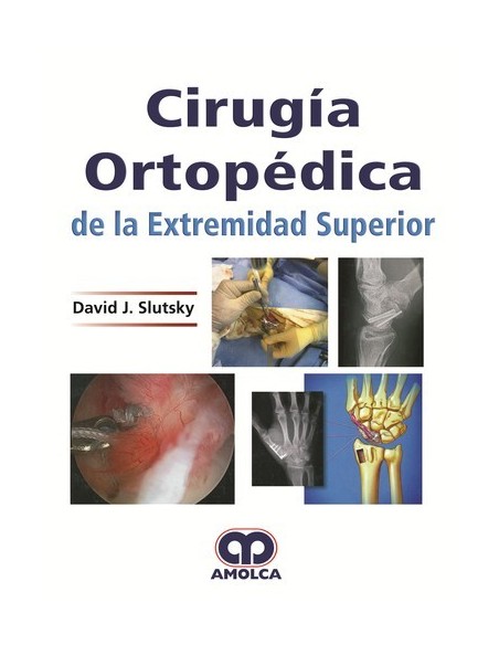 Cirugía Ortopédica de la Extremidad Superior