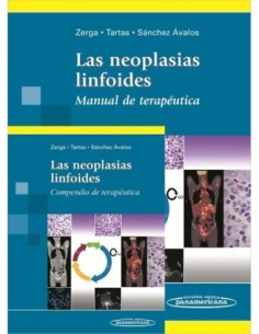 Las neoplasias linfoides. Manual de terapéutica + Compendio de terapéutica