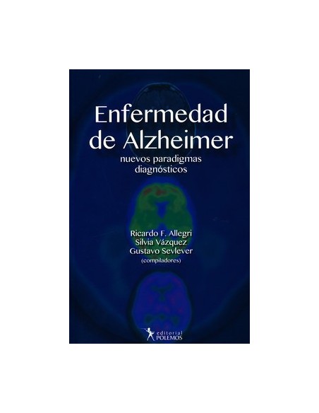 Enfermedad de Alzheimer. Nuevos Paradigmas Diagnósticos