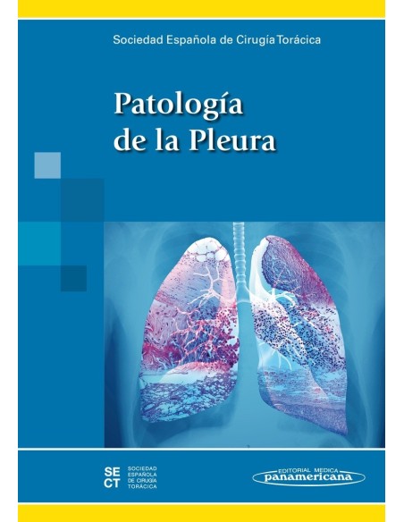 Patología de la pleura