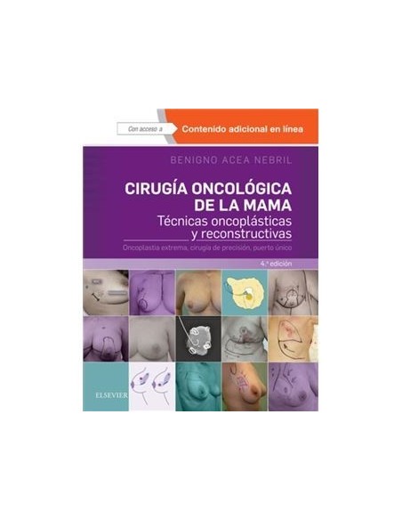 Cirugía oncológica de la mama Técnicas