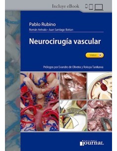 Neurocirugía vascular