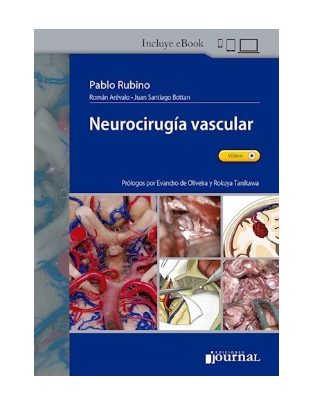 Neurocirugía vascular