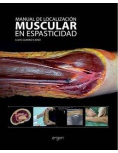 Manual de Localización Muscular en Espasticidad