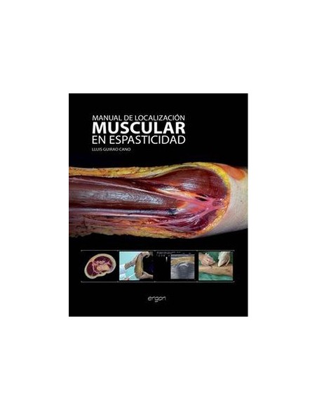 Manual de Localización Muscular en Espasticidad