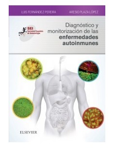 Diagnóstico y monitorización de las enfermedades autoinmunes: Sociedad Española de Inmunología