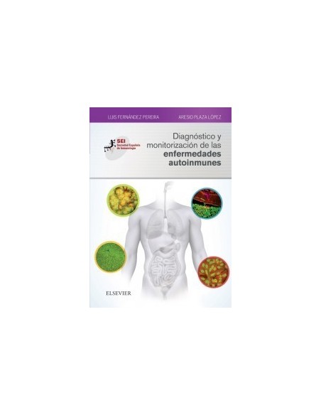 Diagnóstico y monitorización de las enfermedades autoinmunes: Sociedad Española de Inmunología