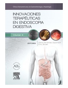 Innovaciones terapéuticas en endoscopia digestiva: Clínicas Iberoamericanas de Gastroenterología y Hepatología vol. 6