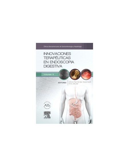 Innovaciones terapéuticas en endoscopia digestiva: Clínicas Iberoamericanas de Gastroenterología y Hepatología vol. 6
