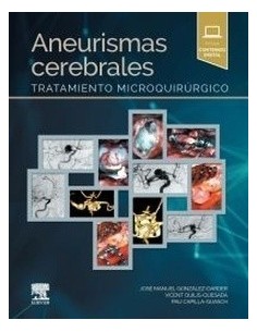 Aneurismas cerebrales