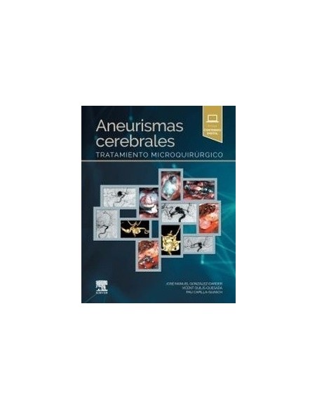Aneurismas cerebrales