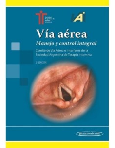 Vía aérea Manejo y control integral