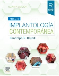 Implantología contemporánea