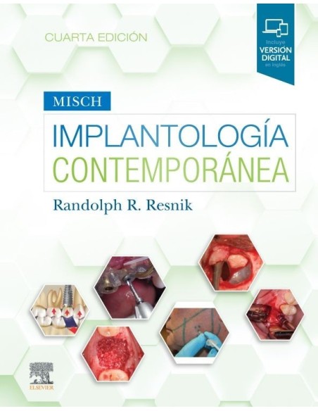 Implantología contemporánea