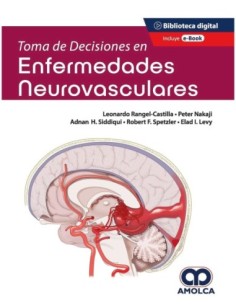 Toma de Decisiones en Enfermedades Neurovasculares