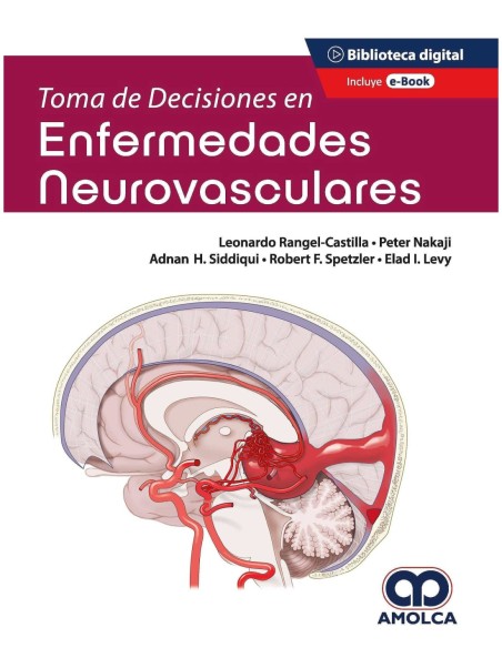 Toma de Decisiones en Enfermedades Neurovasculares