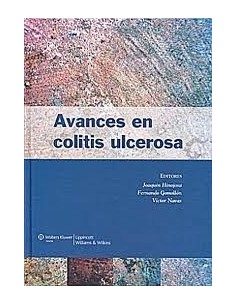Avances en Colitis Ulcerosa