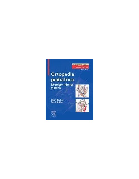 Ortopedia Pediátrica "Miembro Inferior y Pelvis"
