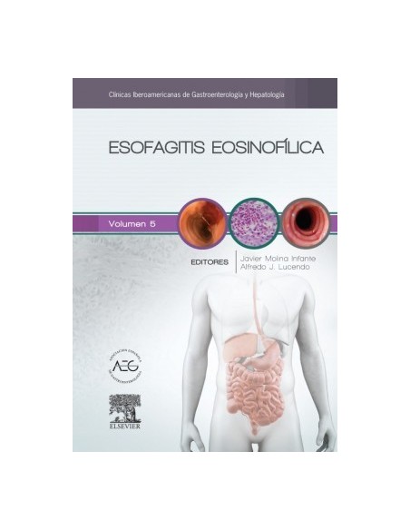 Esofagitis eosinofílica: Clínicas Iberoamericanas de Gastroenterología y Hepatología vol. 5