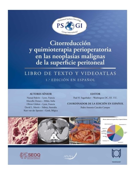 Citorreducción y Quimioterapia Perioperatoria en las Neoplasias Malignas de la Superficie Peritoneal