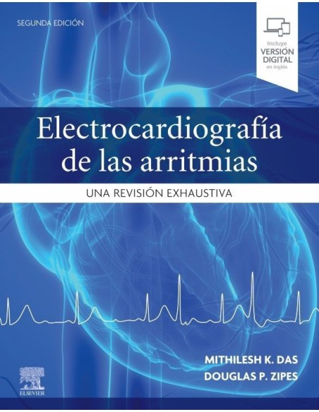 Electrocardiografía de las arritmias