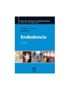 Endodoncia
