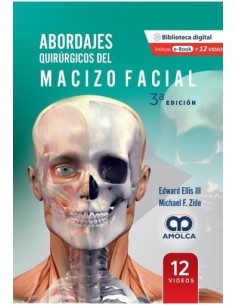Abordajes Quirúrgicos del Macizo Facial