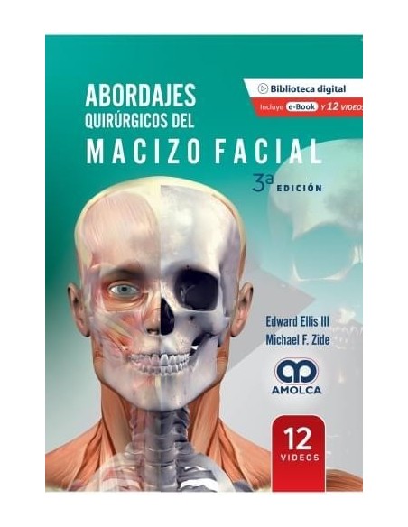 Abordajes Quirúrgicos del Macizo Facial