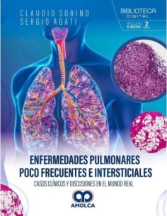Enfermedades Pulmonares Poco Frecuentes e Intersticiales