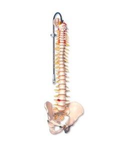 Columna flexible – versión de lujo