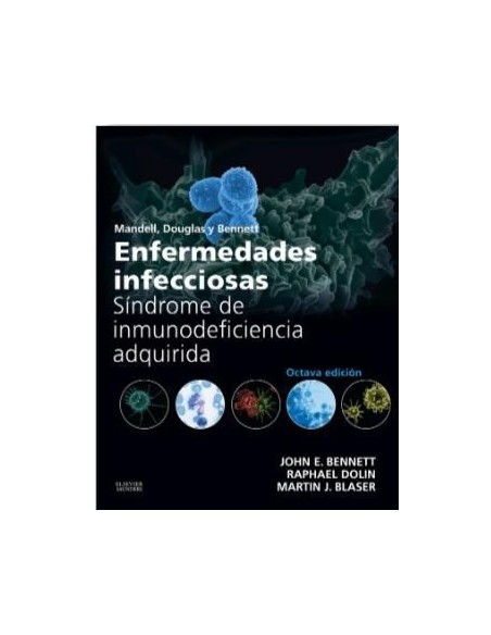 Enfermedades infecciosas. Síndrome de inmunodeficiencia adquirida