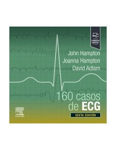 160 casos de ECG